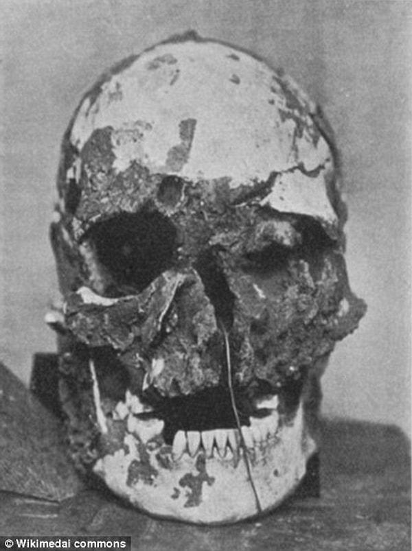 Cheddar Adam, kafatasında açılarn 2mm bir delikten çıkarılan kemik tozu sayesinde gün ışığına çıkarılmış oldu. Ayrıca kafatasındaki daybelere bakılırsa oldukça vahşet içeren bir şekilde ölmüştü.