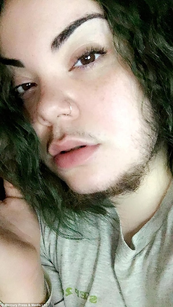 4. У 24-летней Алмы Торрес были такие же проблемы, как у Анналисы. Ситуация с Алмой была еще более сложной.