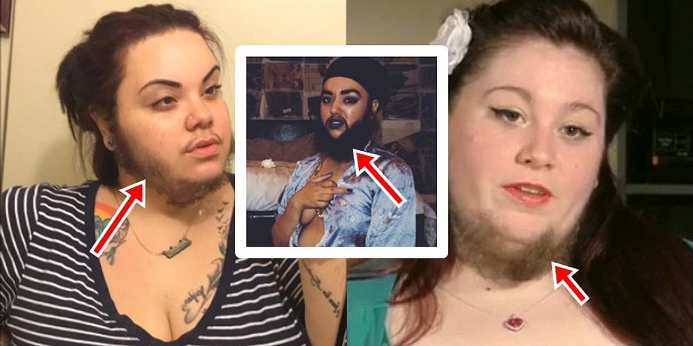 О, ужас! Число женщин, отращивающих бороду, растет с каждым днем!