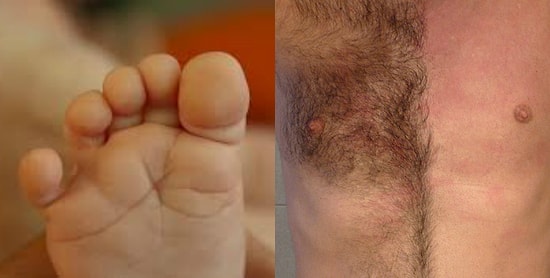 15 частей человеческого тела, которые могут исчезнуть в ближайшем будущем