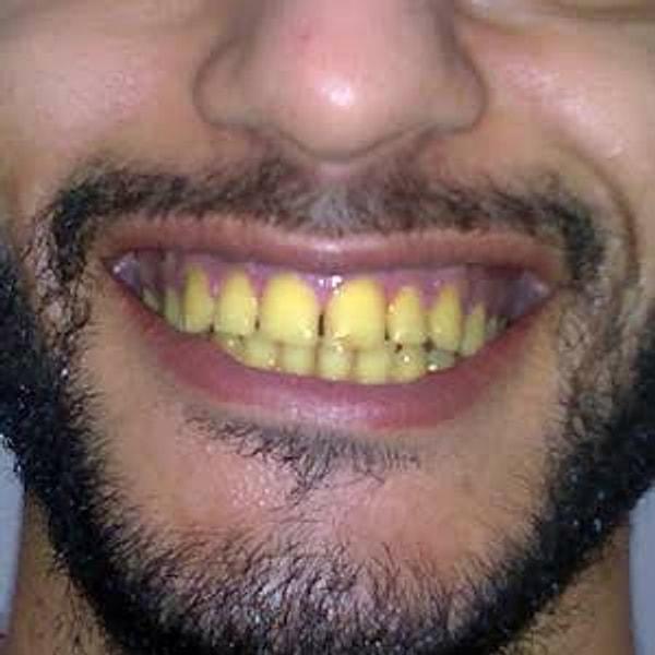 3. Dişlerinizi fırçalayarak kesinlikle vakit kaybetmeyin; mısır koçanı gibi sapsarı bir ağızla dolaşın.