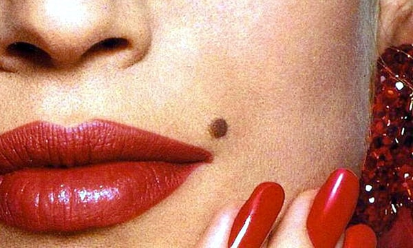 2. У кого есть такая симпатичная родинка?