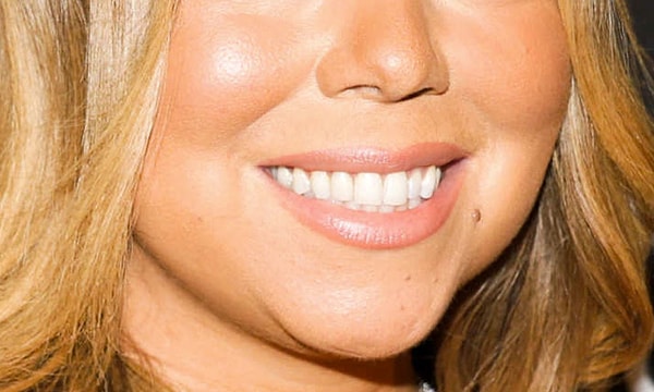 8. Чья эта белоснежная улыбка?