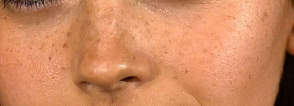 10. Что думаете? Кому принадлежат эти веснушки?