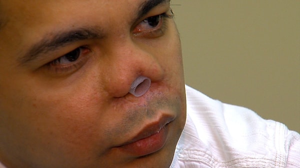 1. Мужчина, оставшийся без носа