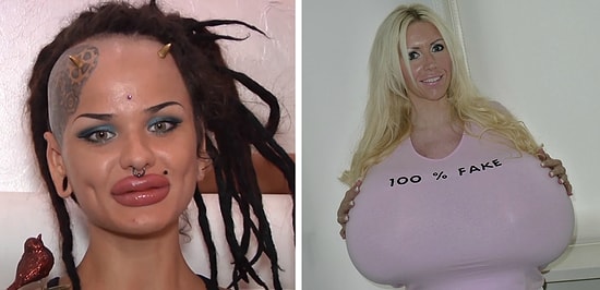 Жертвы хирургов и собственных мозгов: 9 людей, чья внешность заставит вас содрогнуться