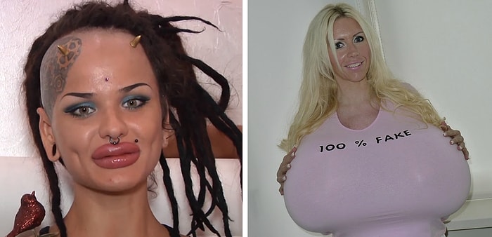 Жертвы хирургов и собственных мозгов: 9 людей, чья внешность заставит вас содрогнуться