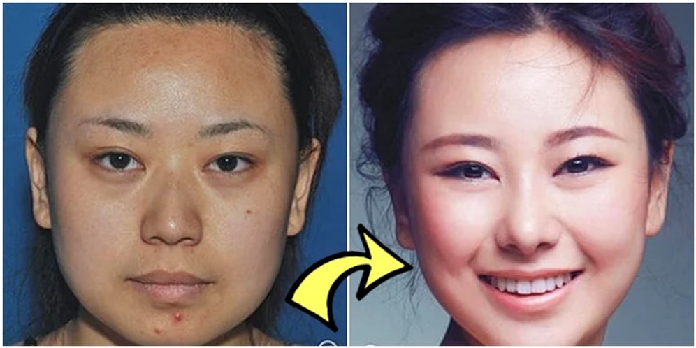 Doktor, Beni Baştan Yarat! Estetik Operasyonlarla Başka Bir İnsana Dönüşen 19 Asyalı Kadın