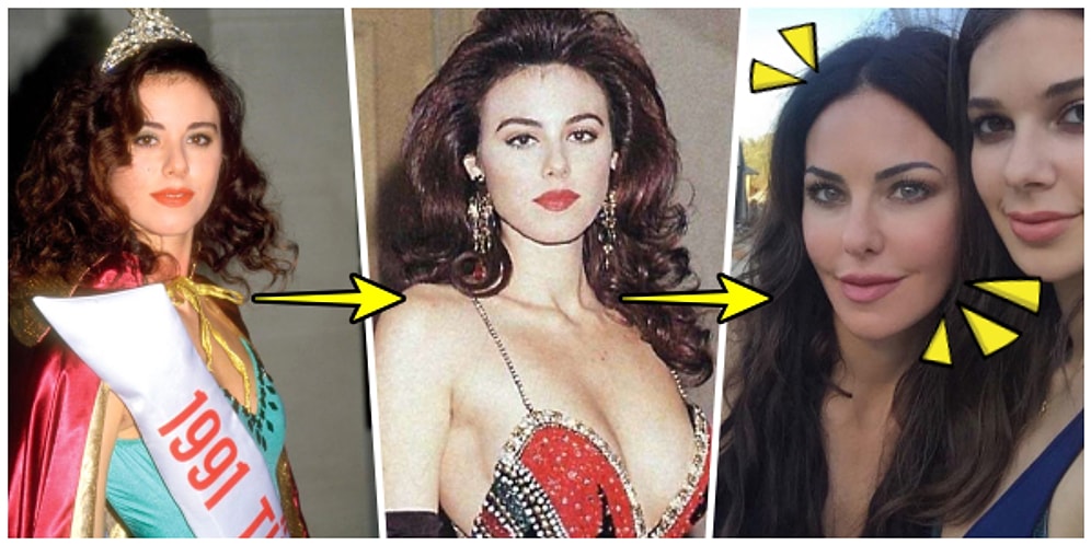 Bir Değişti Pir Değişti! Kızları Boyunu Geçtikten Sonra Estetiğe Başvuran Defne Samyeli'nin Yıldan Yıla Evrimi