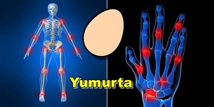 Halk arasında "İltihaplı Romatizma" Olarak Bilinen Romatoid Artrit Ağrılarına İyi Gelebilecek Besinler