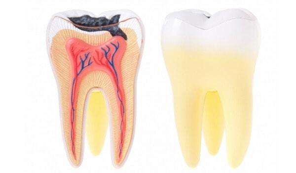 Öncelikle ilacın etkili olduğu “diş çürüğü” problemini anlayalım.