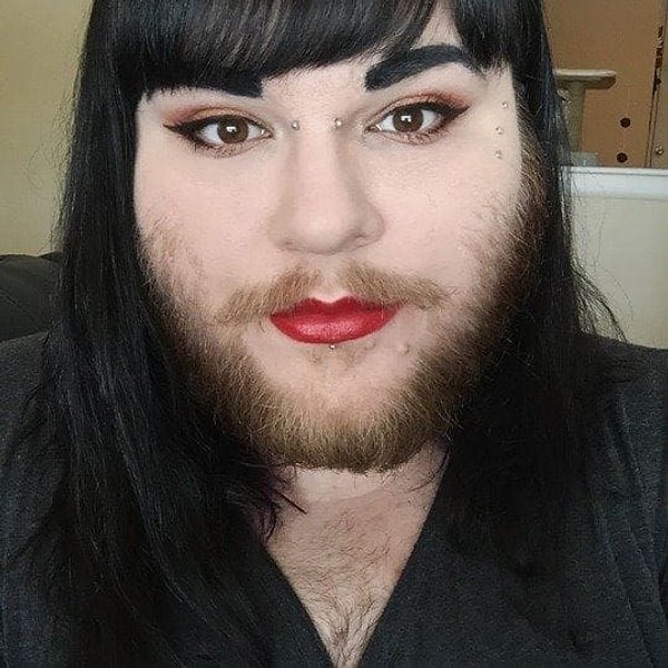 2. У каждого человека симптомы могут быть абсолютно разными, но основными из них являются бесплодие, болезненные периоды и гармональный дисбаланс. В случае Новы - это большое количество волос на лице, груди и животе.