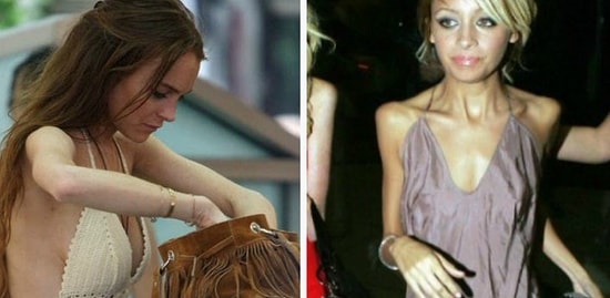 10 женщин-звезд, которые были «кожа да кости», но смогли прийти в норму