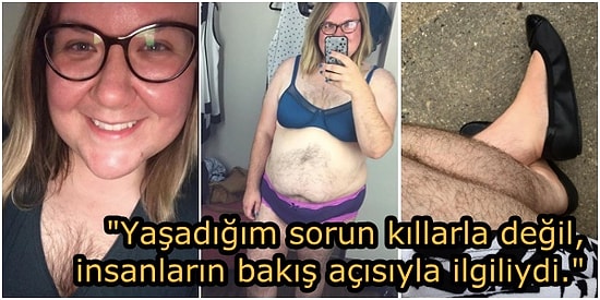 Yıllarca Utandığı Aşırı Kıllı Vücuduyla Barışıp, Sürekli Tıraş Olmaktan Vazgeçen Kadın!
