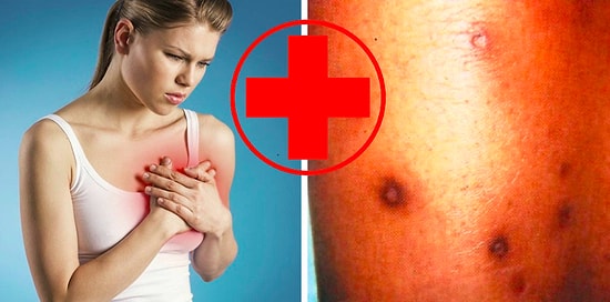 Тест: Только настоящие светилы медицины смогут определить болезнь по её симптому на 10/10!