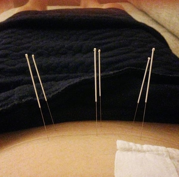 21. Существует такое явление, как "бесплодие неясного генеза"