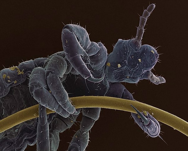 Вши сами по себе неприятны, но увидеть вшу еще и под микроскопом… Бррр! То еще зрелище.