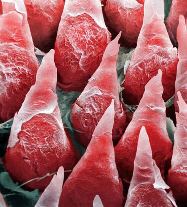 Поверхность языка покрыта вкусовыми почками и листовидными сосочками, последние можно хорошо разглядеть на этом снимке.