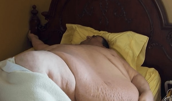 4. Несмотря ни на что, Роберта все-таки перевезли в центр реабилитации в Хьюстоне, и он смог сбросить 56 кг в первый месяц.