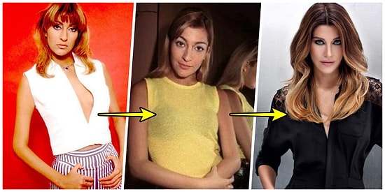 Çok Çok Estetik Annecim! İşte Deniz Akkaya'nın Küçük Dilinizi Yutturacak Yıldan Yıla Değişimi! 😱