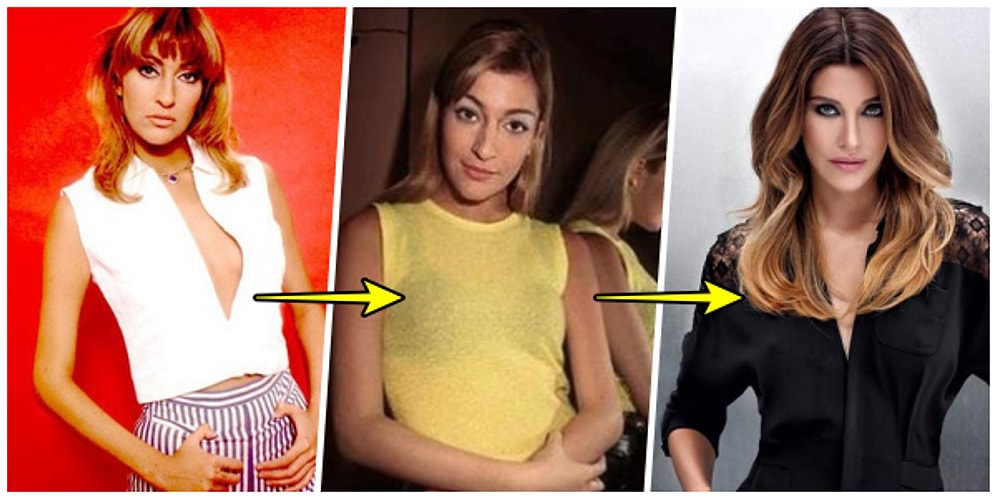 Çok Çok Estetik Annecim! İşte Deniz Akkaya'nın Küçük Dilinizi Yutturacak Yıldan Yıla Değişimi! 😱