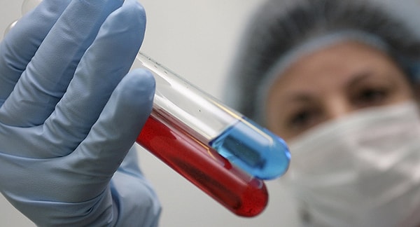 6. Какие способы передачи ВИЧ существуют?