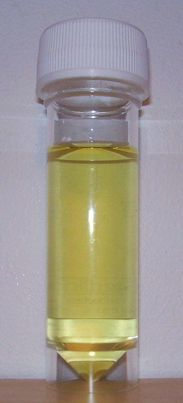 5. Частые позывы к мочеиспусканию могут указывать на наличие диабета 2-го типа