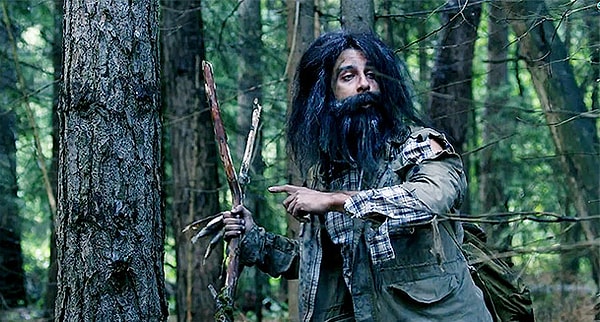 3. Упс! Вы порезались, да не слабо! Куда нужно наложить жгут при артериальном кровотечении?