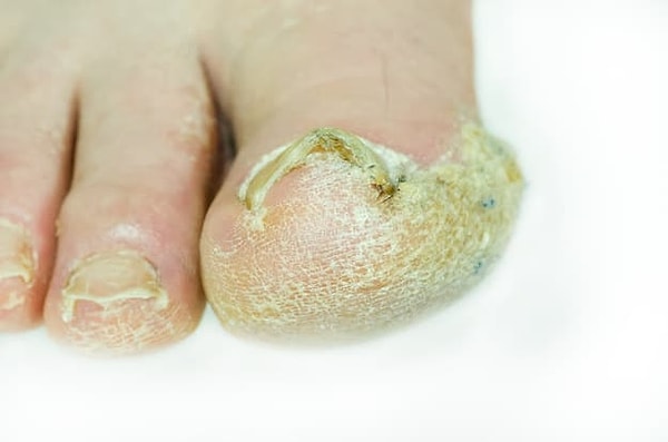 6. Смогли бы взять в рот этот отвратительный палец?