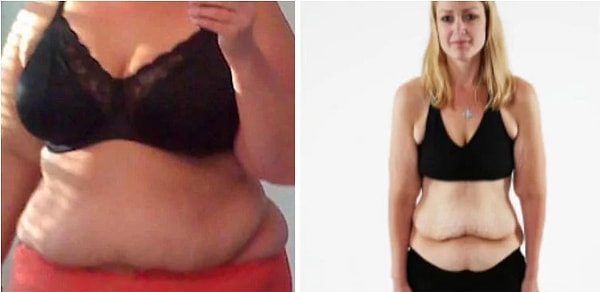 Луана похудела на 83 кг.