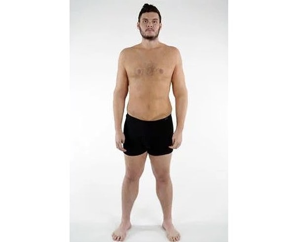 А это его фото после операции по удалению лишней кожи.