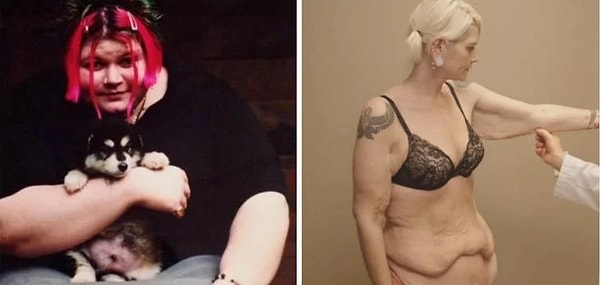 4. Калисто похудела на 113 кг!!!