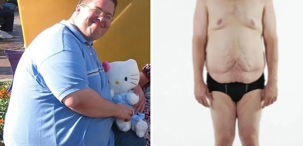 5. Этого молодого человека зовут Тим. И он смог сбросить 102 кг.