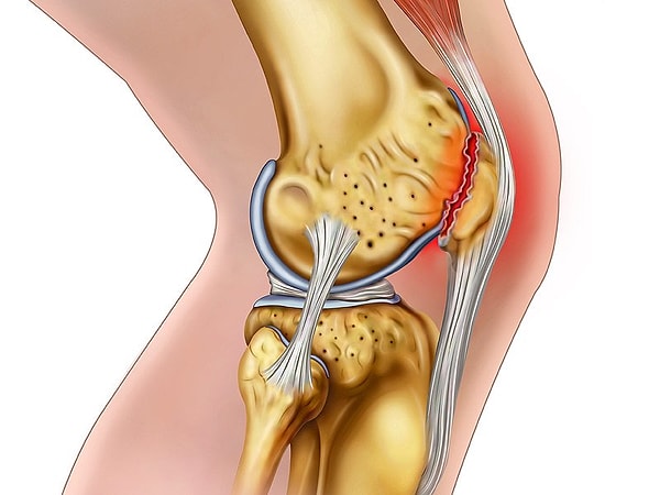 8. Хрящ — это...