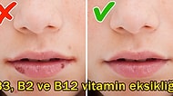 Göz Ardı Etmeyin! Vücudunuzun 'Vitaminim Bitti!' Diye Çığlık Attığını Gösteren 8 İşaret