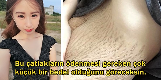Doğum İzlerinden Ötürü Mide Bulandırıcı Olduğu Söylenen 23 Yaşındaki Annenin Ağızlara Pay Niteliğinde Cevapları