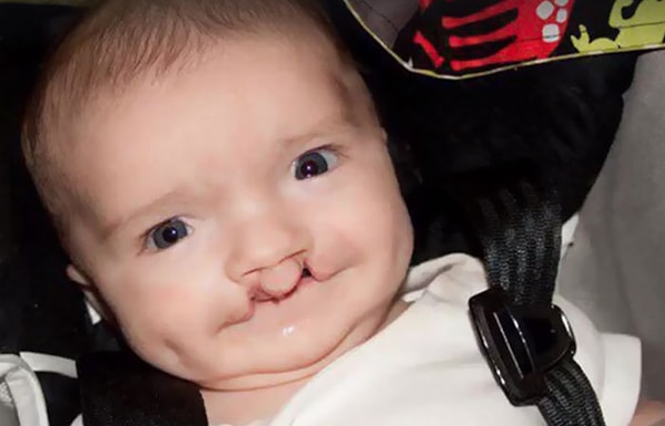 6. Мэдден перенес 6 операций.