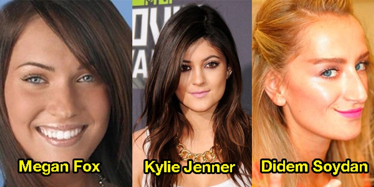 Estetik Sevdalari Bitmek Bilmiyor Dudaklarina Silikon Yaptiran 31 Unlu Estetik Sevdalari Bitmek Bilmiyor Dudaklarina Silikon Yaptiran 31 Unlu