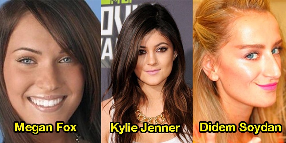 Estetik Sevdaları Bitmek Bilmiyor! Dudaklarına Silikon Yaptıran 31 Ünlü