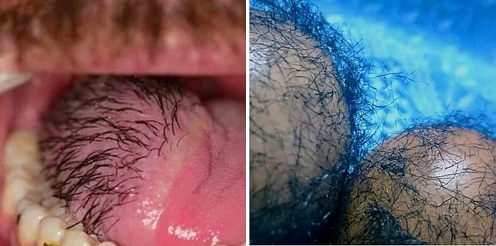 10 Kişiden 9'u Son Fotoğrafa Gelemiyor! İnternetin Koltuk Altından Çıkan İğrenç 19 Fotoğraf