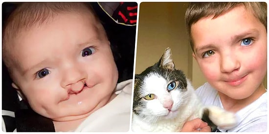 Farklı Göz Rengi ve Yarık Dudağı Sebebiyle Zorbalığa Maruz Kalan 7 Yaşındaki Madden'a Mutluluk Veren Yol Arkadaşı!