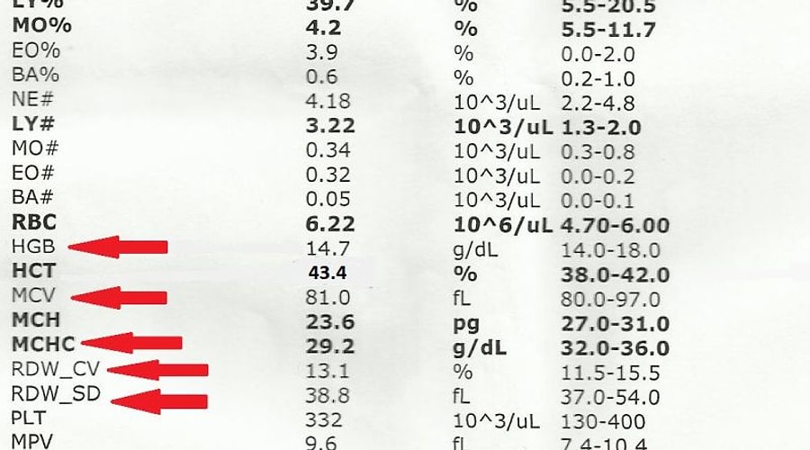 Kan Değerlerinizi Ölçen MCV Nedir? MCV Hakkında Bilmeniz Gereken 5 Şey ...