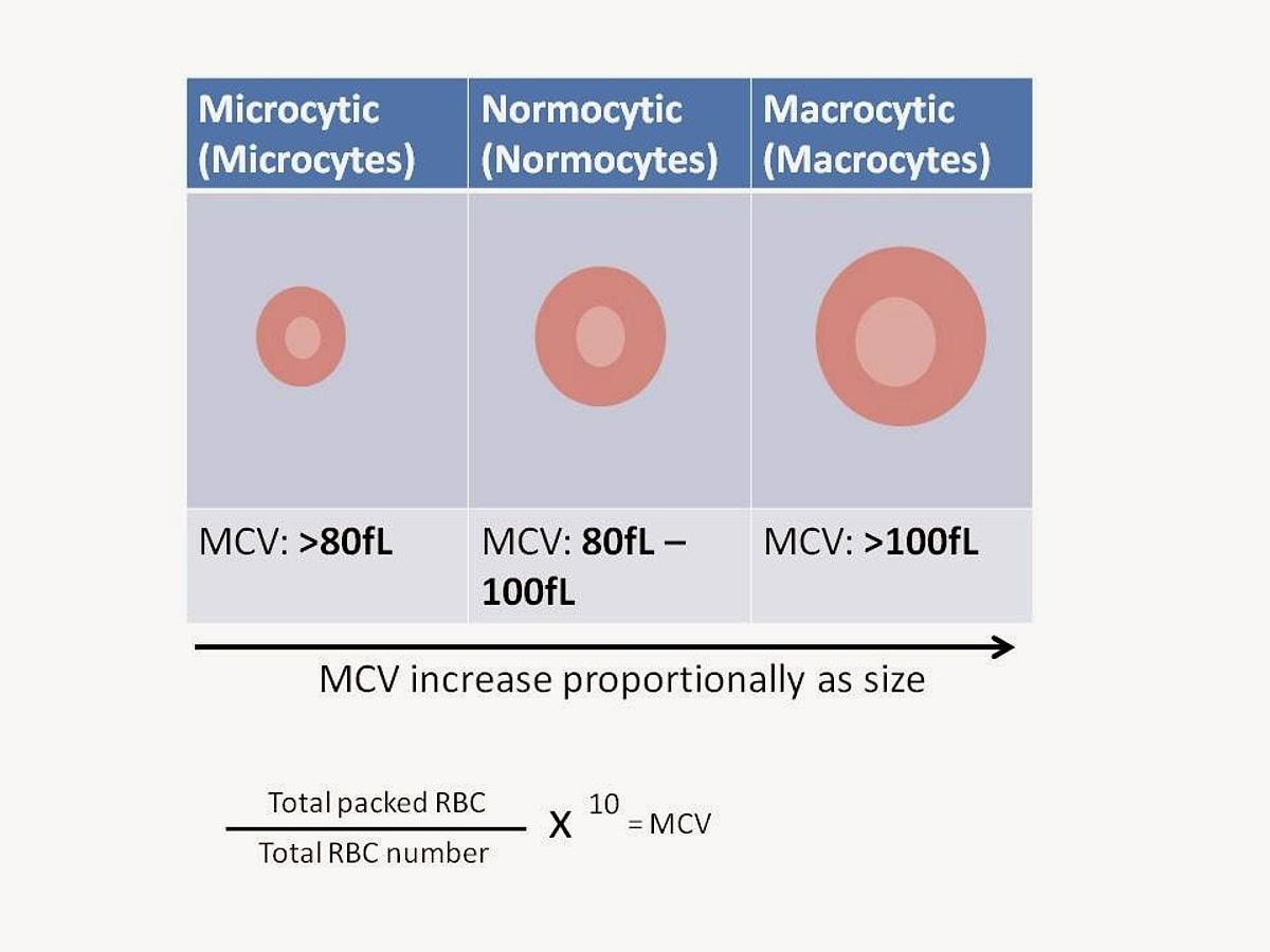 Mch анемия. MCHC И MCH разница. MCV Red Cell. MCH картинка. MCH (mean Cell hemoglobin).
