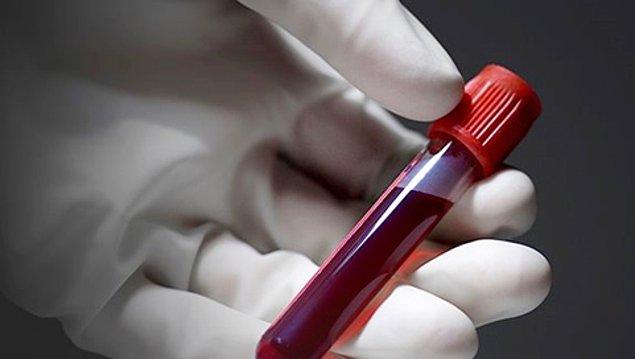 İdeal Hemoglobin(HGB) Değerleri Nelerdir?