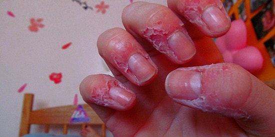 Modern İnsanın Vebası: Değiştiremeyeceği Şeyleri Dert Edinmek!