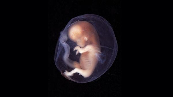 4. İnsan embriyosunun oluşan ilk kısmı anüstür. Yani hepimiz aslında önce birer anüs olarak bu hayata başlıyoruz.