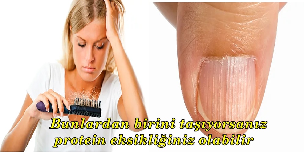 Aman Dikkat! Vücudunuzda Protein Eksikliği Olduğunu Gösteren 8 İşaret