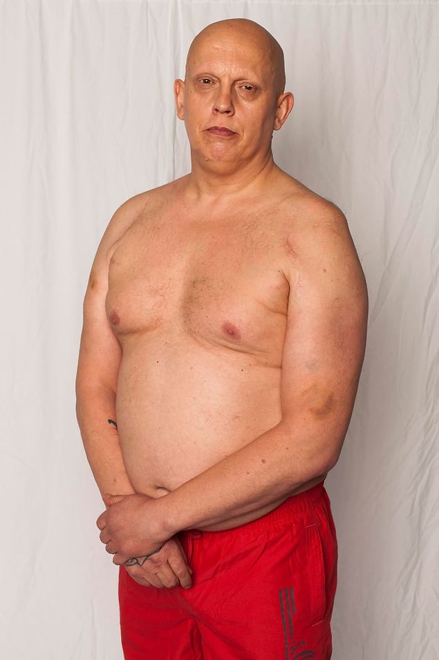 Roy'da alopesi yani saçkıran var. O eski bir buz hokeyi oyuncusu, fitness delisi ve karate dövüşçüsü.