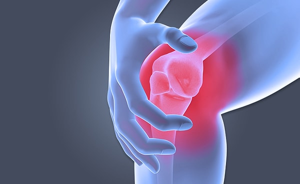 2. Повышенная подвижность коленного сустава