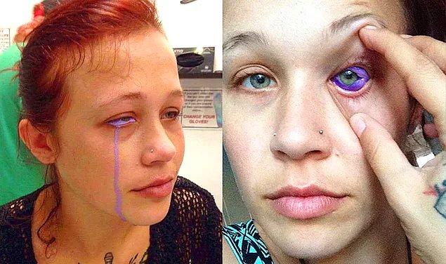 35. Yaptırdığı Dövme Sonrasında Gözünü Kaybetme Noktasına Gelen Kadın